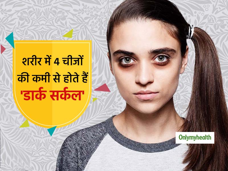 Dark Circle Treatment: शरीर में इन 4 चीजों की कमी से आंखों के नीचे आ जाते हैं डार्क सर्कल, जानें कैसे पूरी करें कमी
